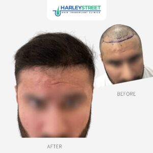 Shreyas Before & Afters Shreyas Before & Afters